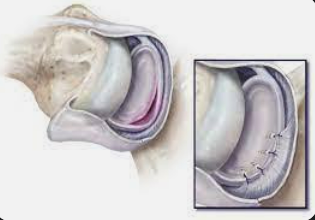 Centre orthopédie Aubagne