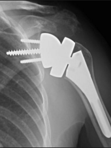 Centre orthopédie Aubagne