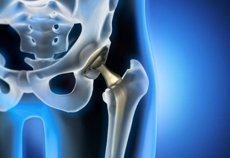 Centre orthopédie Aubagne