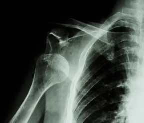 Centre orthopédie Aubagne