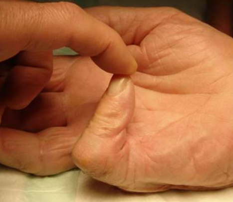 Centre orthopédie Aubagne