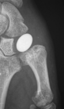 Centre orthopédie Aubagne