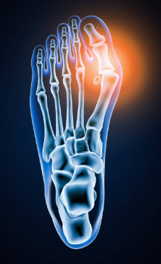 Centre orthopédie Aubagne