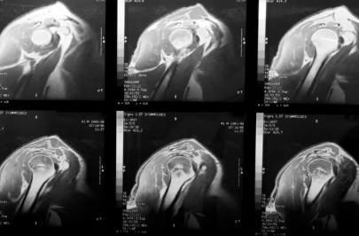 Centre orthopédie Aubagne