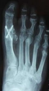 Centre orthopédie Aubagne