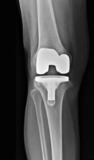 Centre orthopédie Aubagne