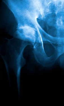 Centre orthopédie Aubagne