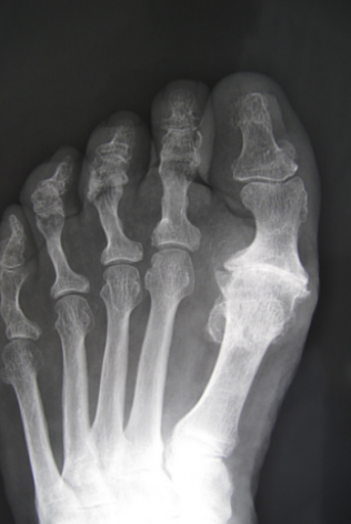 Centre orthopédie Aubagne