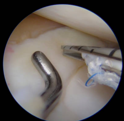 Centre orthopédie Aubagne