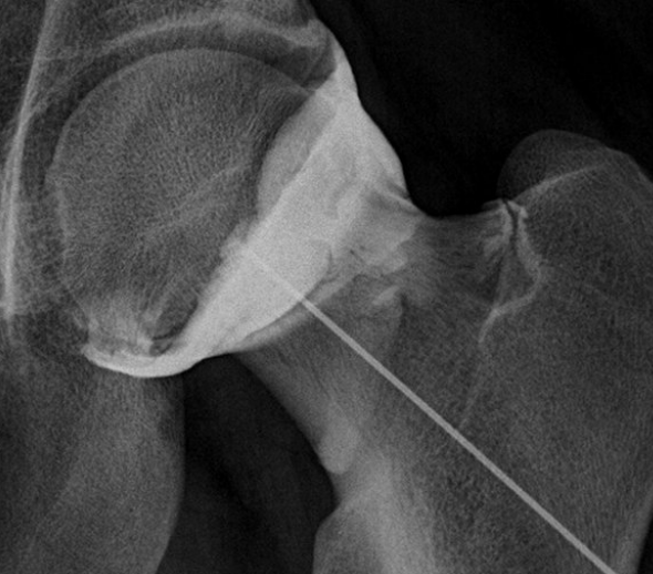 Centre orthopédie Aubagne