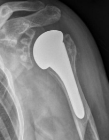 Centre orthopédie Aubagne