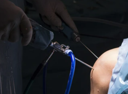 Centre orthopédie Aubagne