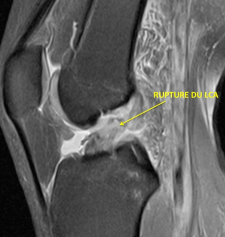 Centre orthopédie Aubagne