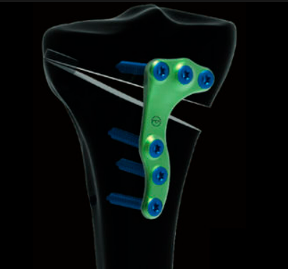 Centre orthopédie Aubagne