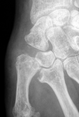 Centre orthopédie Aubagne