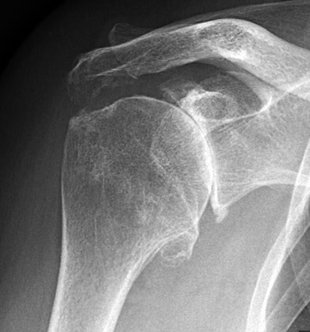 Centre orthopédie Aubagne