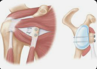 Centre orthopédie Aubagne
