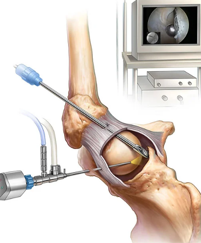 Centre orthopédie Aubagne