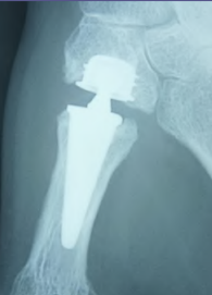 Centre orthopédie Aubagne