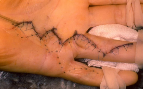 Centre orthopédie Aubagne