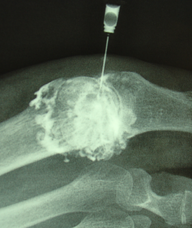 Centre orthopédie Aubagne