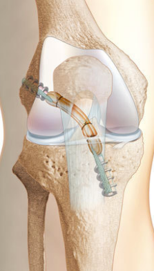 Centre orthopédie Aubagne