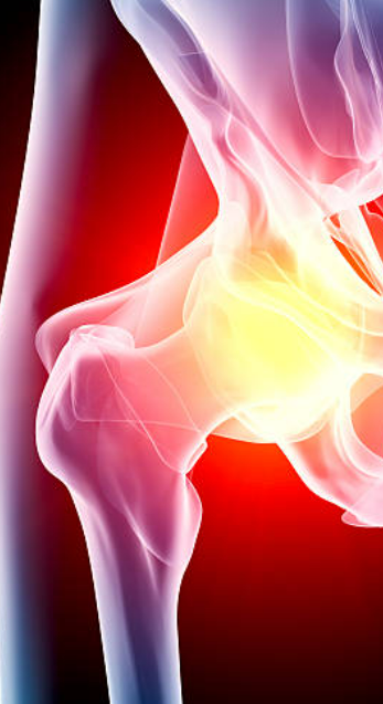 Centre orthopédie Aubagne