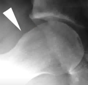 Centre orthopédie Aubagne