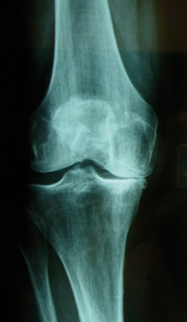 Centre orthopédie Aubagne